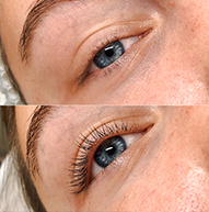 Jämförelse av två ögon, den nedan har lyft fransarna